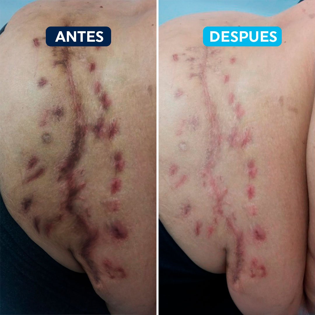 antes-despues-1.jpg