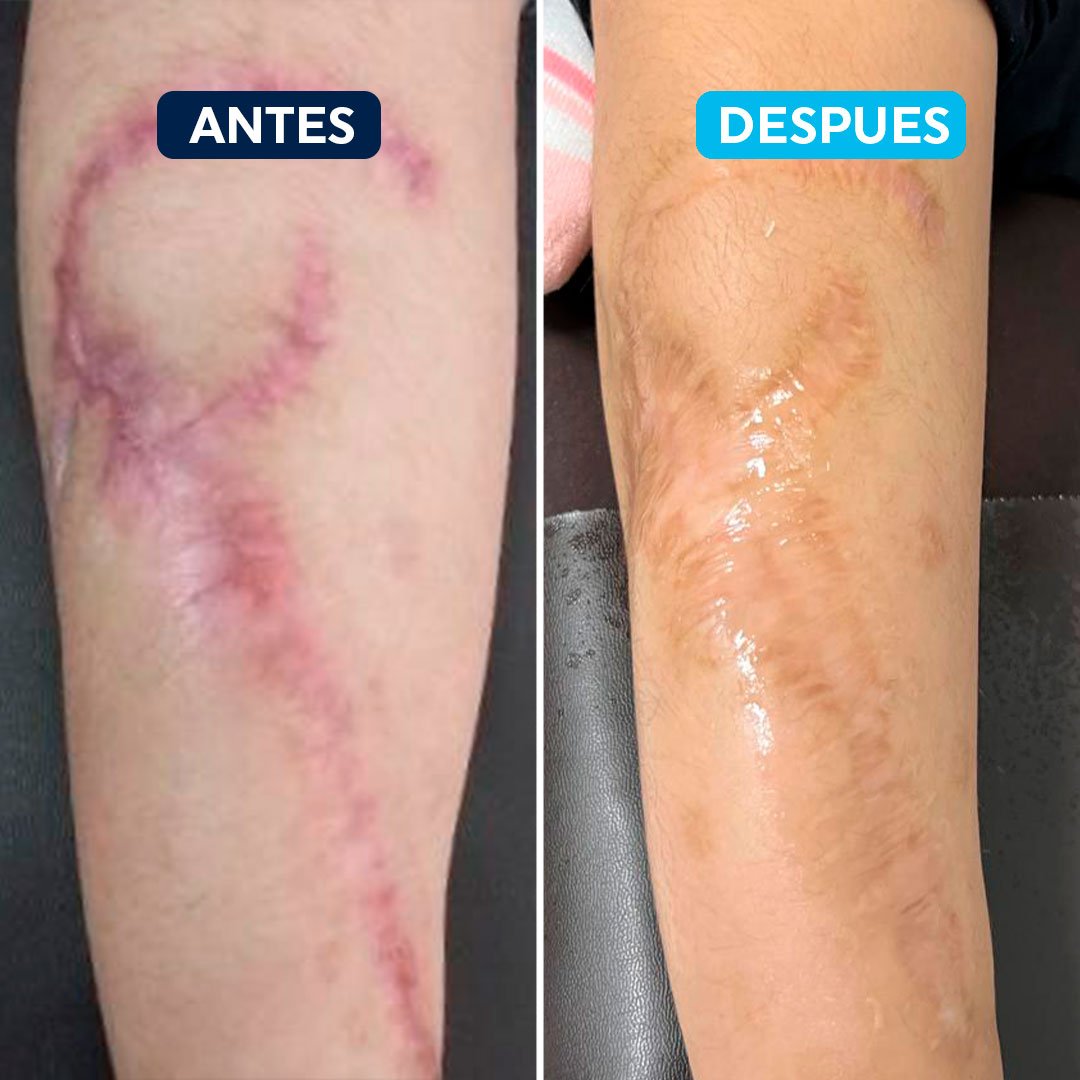 antes-despues-2.jpg