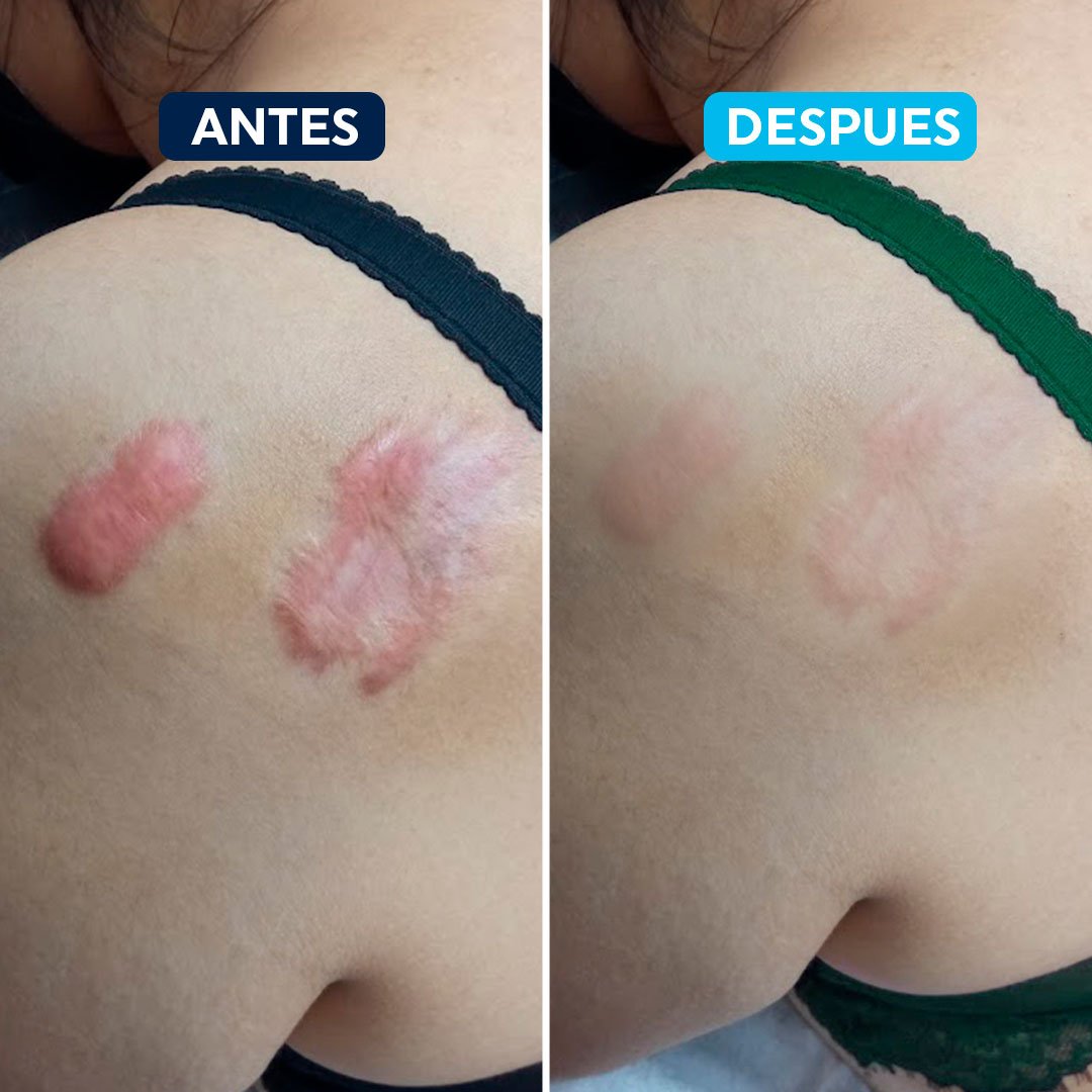 antes-despues-3.jpg