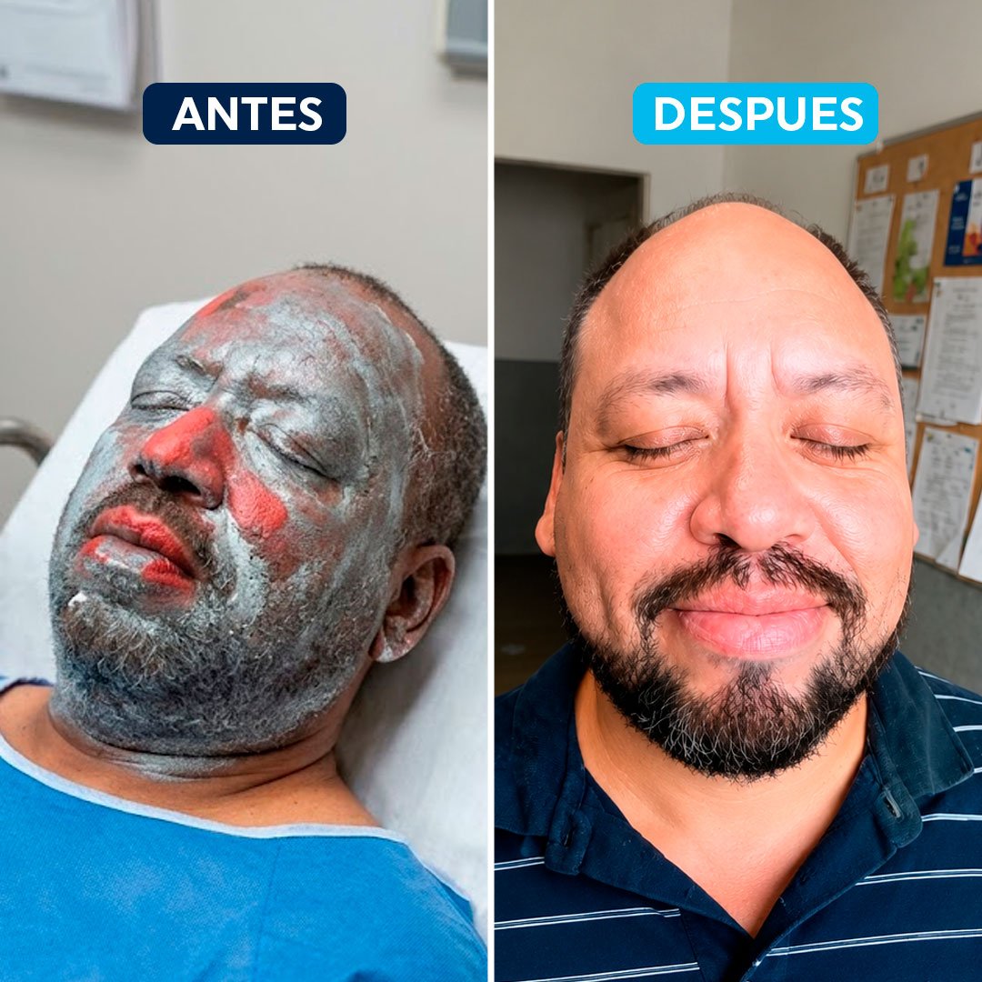 antes-despues-4.jpg