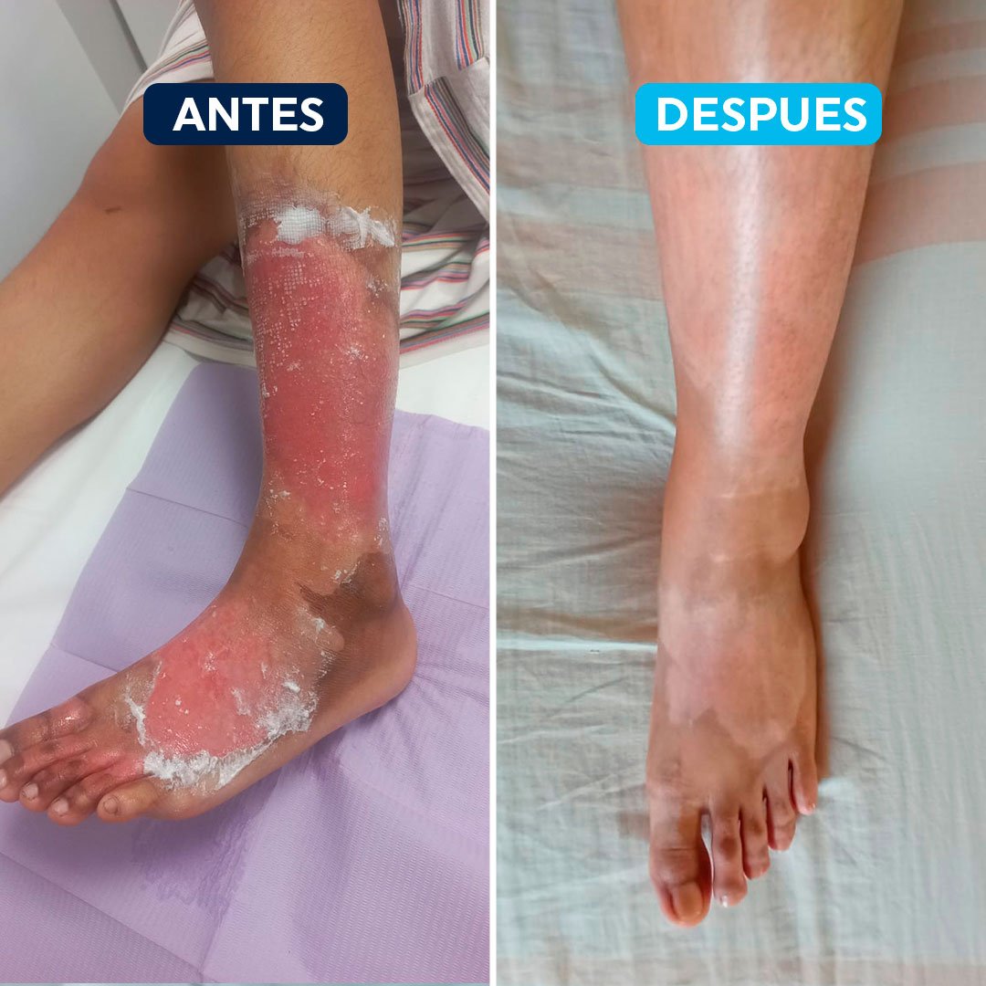 antes-despues-6.jpg