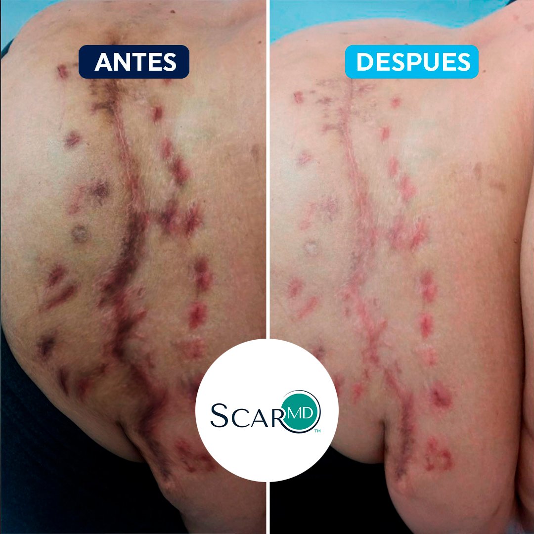 antes-despues-1