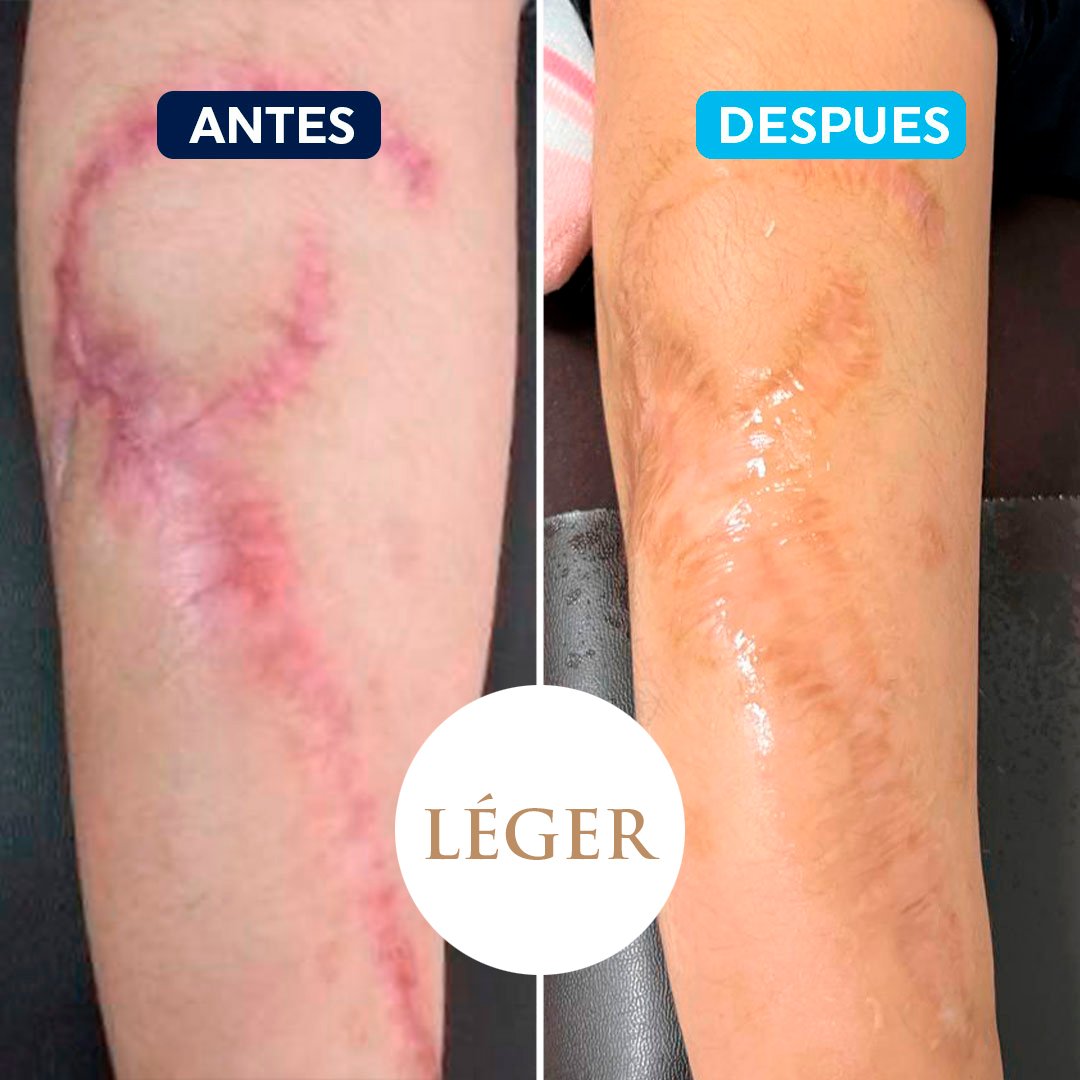 antes-despues-2