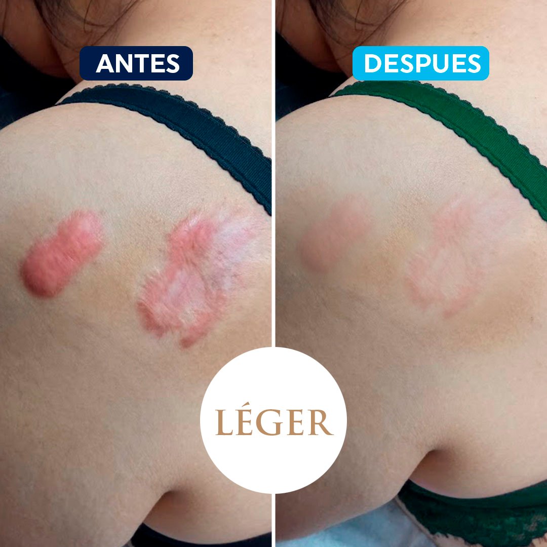 antes-despues-3