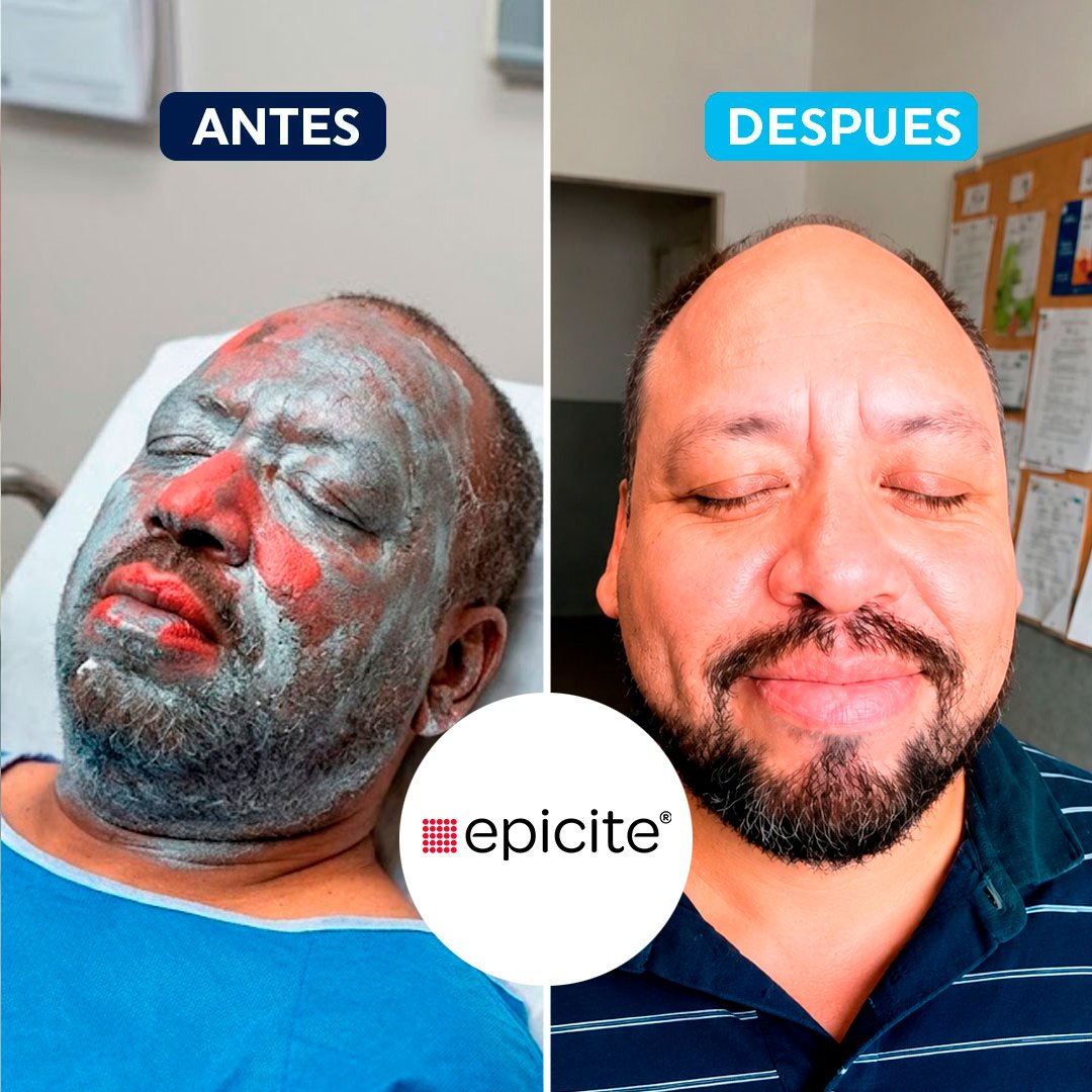 antes-despues-4