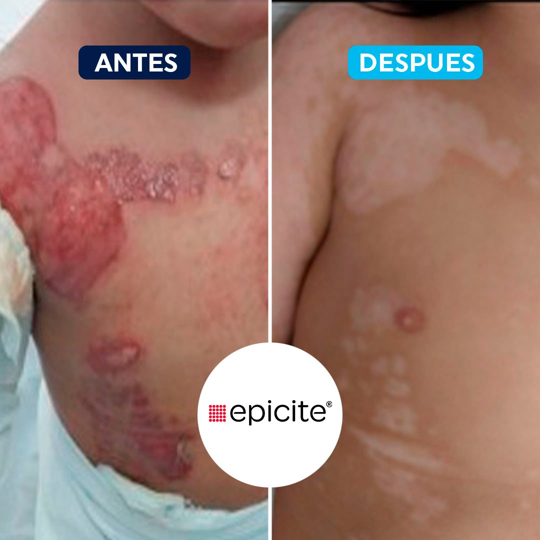 antes-despues-5