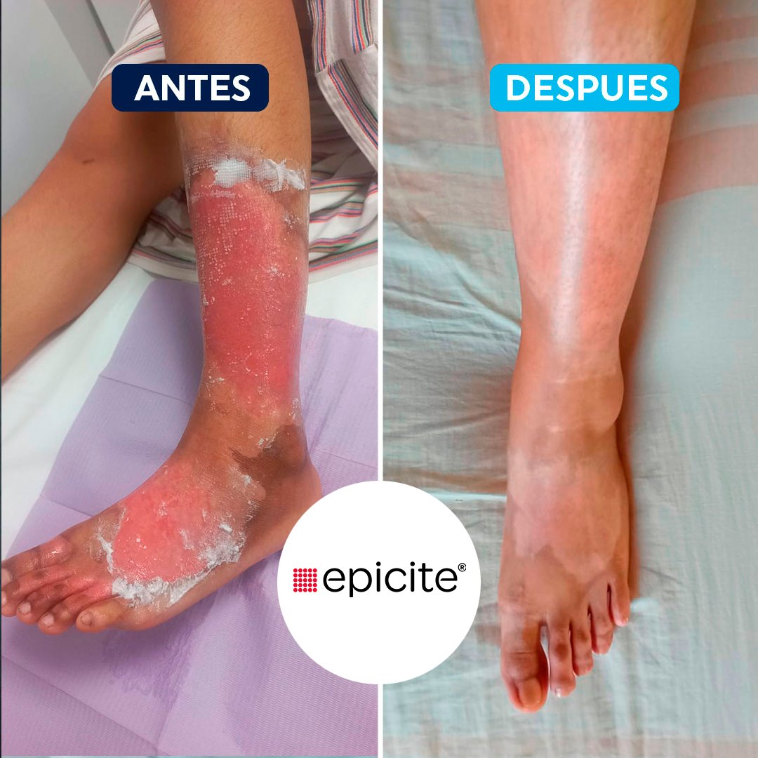 antes-despues-6