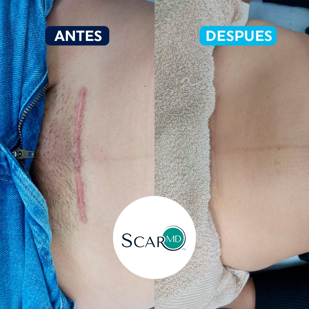antes-despues-7